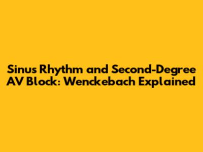 Sinus Rhythm and Second-Degree AV Block: Wenckebach Explained